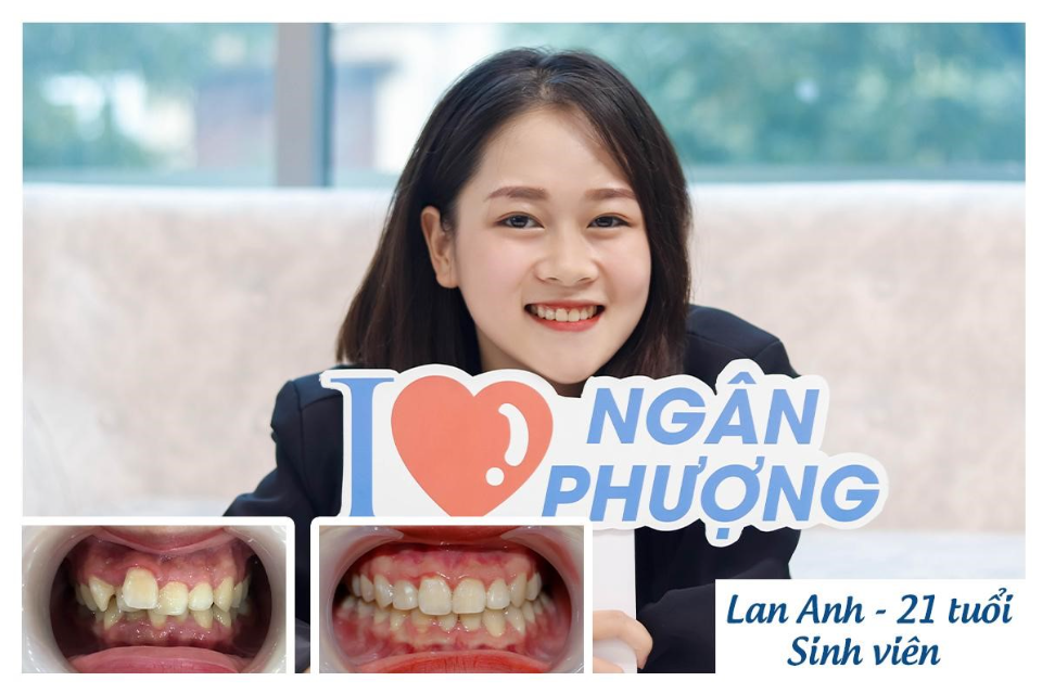 Hình ảnh thiết bị