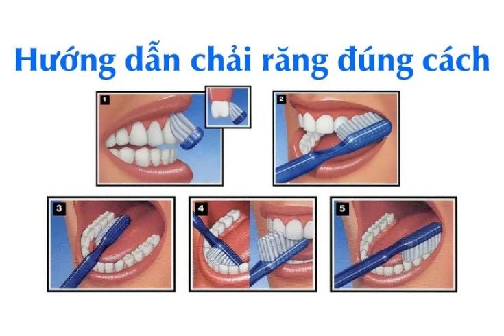 ban-chai-danh-rang-bi-quyet-danh-rang-dung-cach-7.jpg