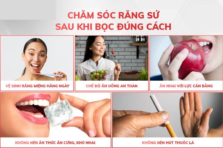 boc-rang-su-phuong-phap-phuc-hinh-rang-pho-bien-6.jpg